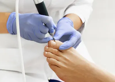 Specjalistyczny Gabinet Podologiczny Zdrowe Stopy